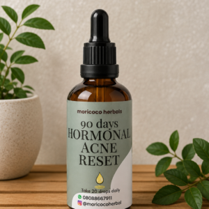 90 Day Hormonal Acne Reset